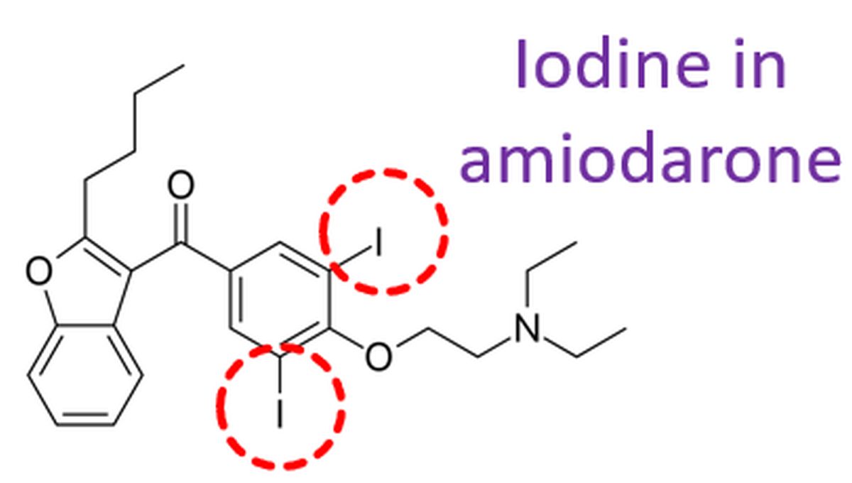 Iodine in amiodarone