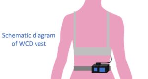 How Good Is A Wearable Cardioverter Defibrillator? – All About ...