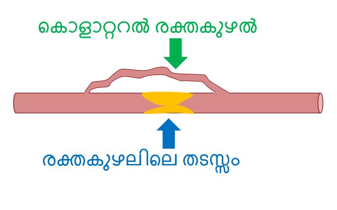 കൊളാറ്ററൽ രക്തകുഴൽ