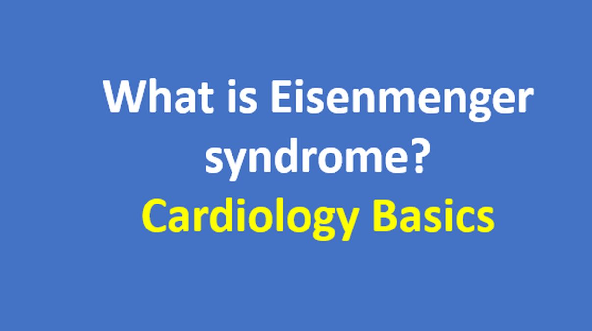 What Is Eisenmenger Syndrome Cardiology Basics All About what-is-eisenmenger-syndrome-cardiology-basics-all-about