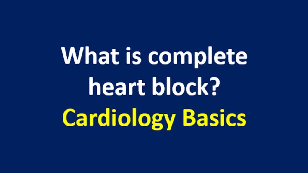 What is complete heart block? Cardiology Basics All About