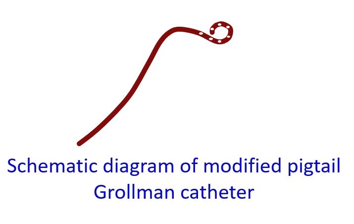 Schematic diagram of modified pigtail Grollman catheter