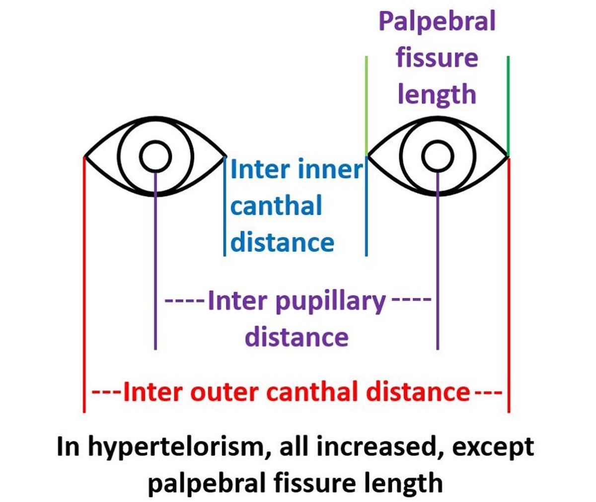Examination of Eyes