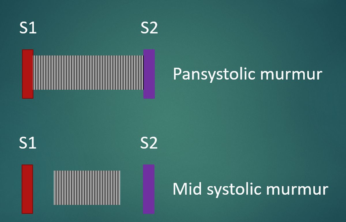 Pansystolic and midsytolic murmurs