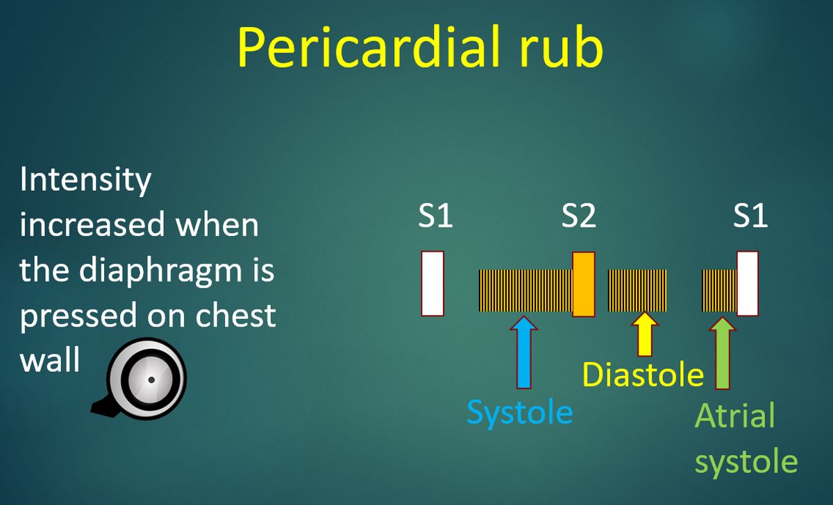 Pericardial rub