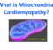 What is Mitochondrial Cardiomyopathy