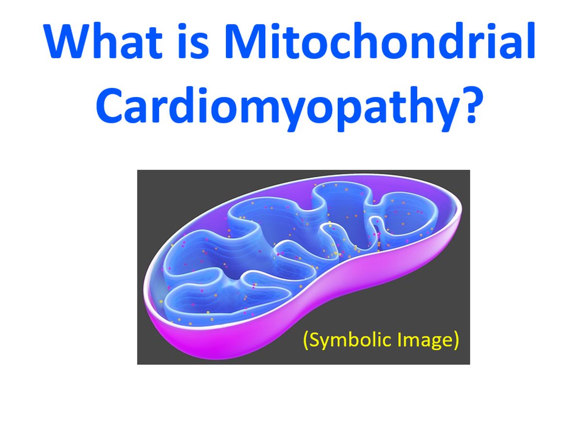 What is Mitochondrial Cardiomyopathy