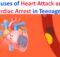 Causes of Heart Attack and Cardiac Arrest in Teenagers