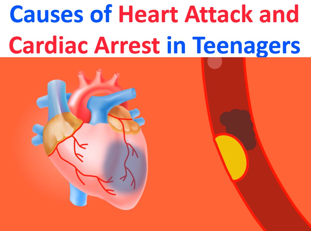 Causes of Heart Attack and Cardiac Arrest in Teenagers