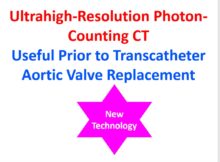 Ultrahigh-Resolution Photon-counting CT Useful Prior to Transcatheter Aortic Valve Replacement