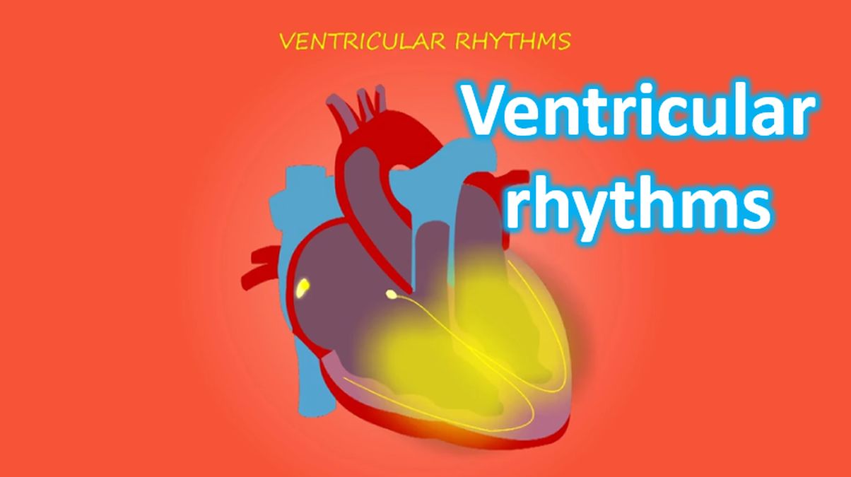 Ventricular Rhy Ventricular rhythms - All About Cardiovascular System and Disorders