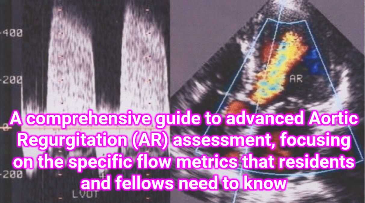 A comprehensive guide to advanced Aortic Regurgitation (AR) assessment ...