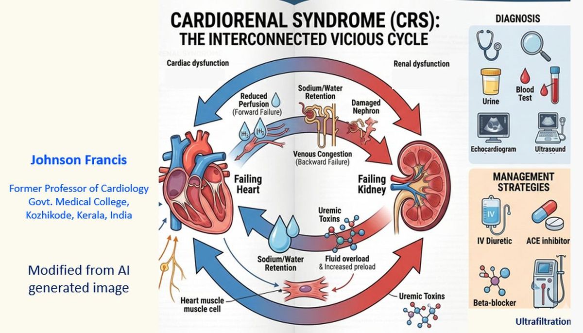 Cardiorenal syndrome - All About Cardiovascular System and Disorders
